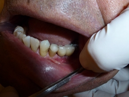 Вижте каталога ни с избелване на зъби 16