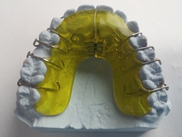 Каталог избелване на зъби 7